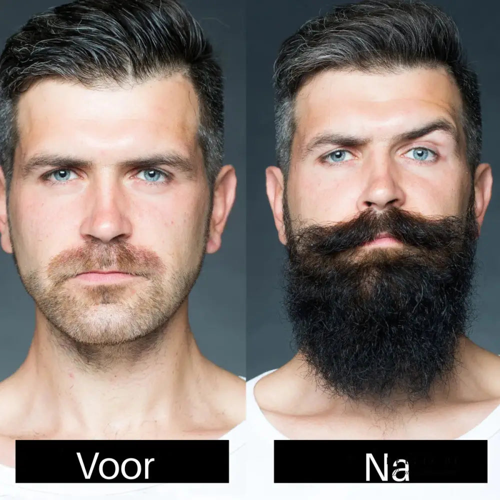 Populair bij Mannen: Complete Baardverzorgingsset – Groei Style & Verzorg Je Baard als een Pro! 1 set
